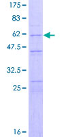 12.5% SDS-PAGE Stained with Coomassie Blue.